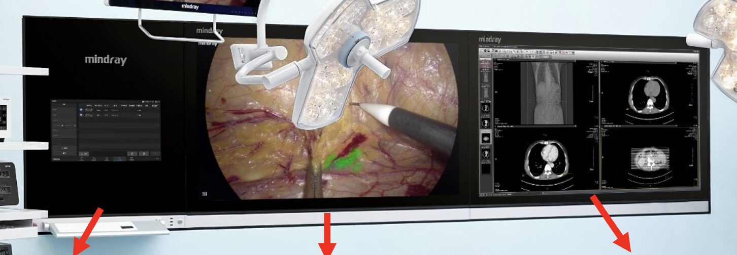 Medical displays with surgical and imaging visuals.