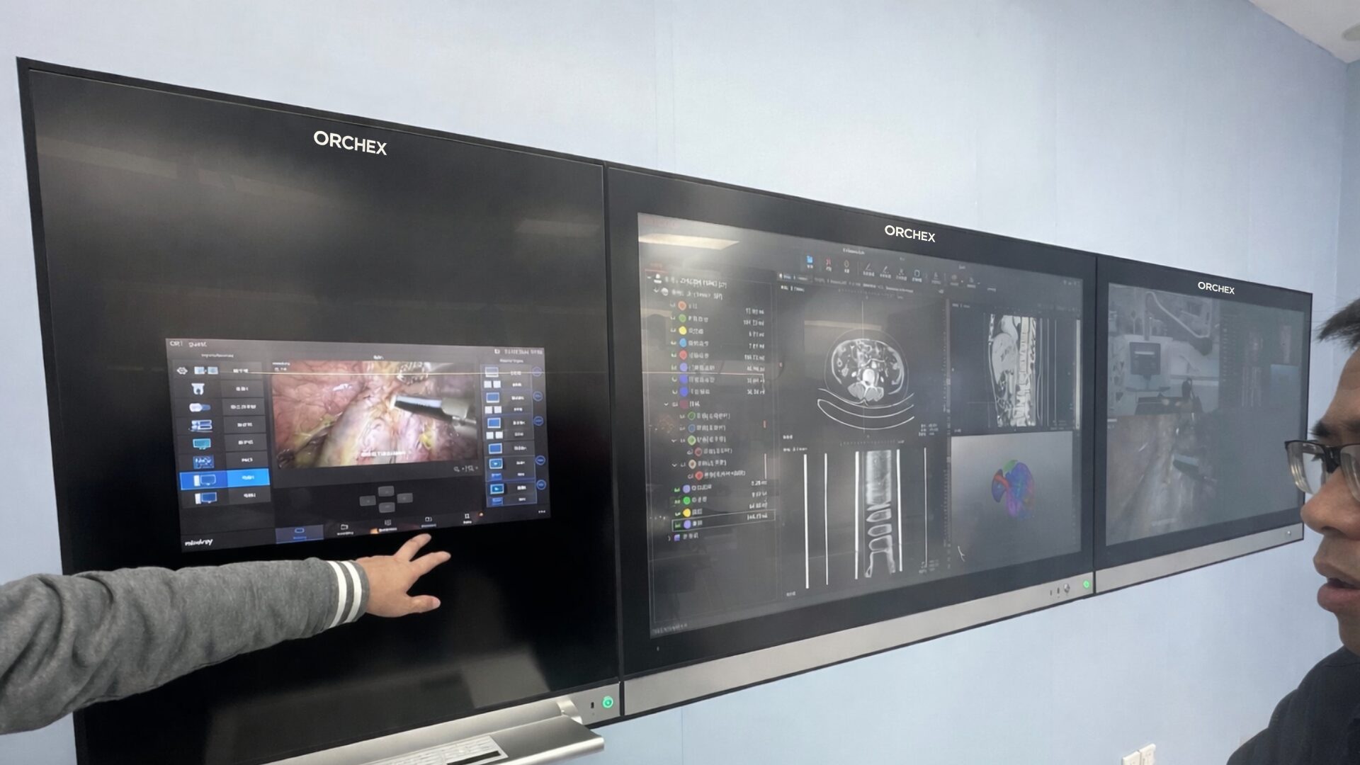 ORCHEX digital operating room platform